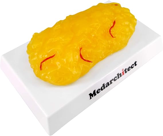 Authentic Human Body Fat Replica with Red Veins - 1 lb, Keep Fit & Weight Loss Motivation & Reminder, Human Fatty Tissue Demonstration Model for Nutritionist, Science Course for Medical Student