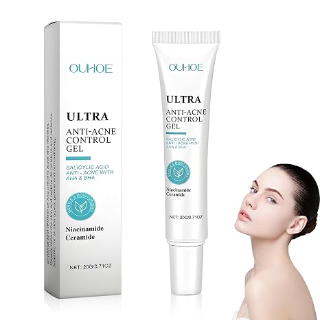 Anti-pimple cream face acne gel with salicylic acid niacinamide