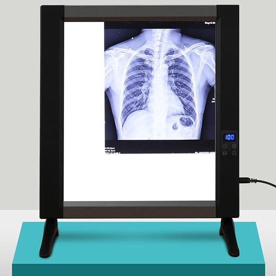 Portable X-Ray Film Illuminated Board Panel, X-ray Viewer Light Box LED Dimmable Prevent Shadows X-ray Film Viewer for Clinic Hospital